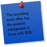 The ascending aorta often has  the greatest enlargement in those with BAV